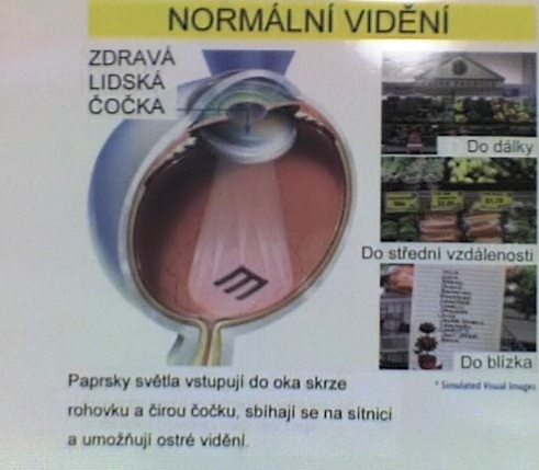 Normální vidění